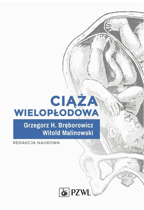 Ciąża wielopłodowa