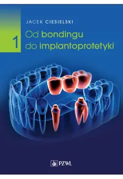 Od bondingu do...