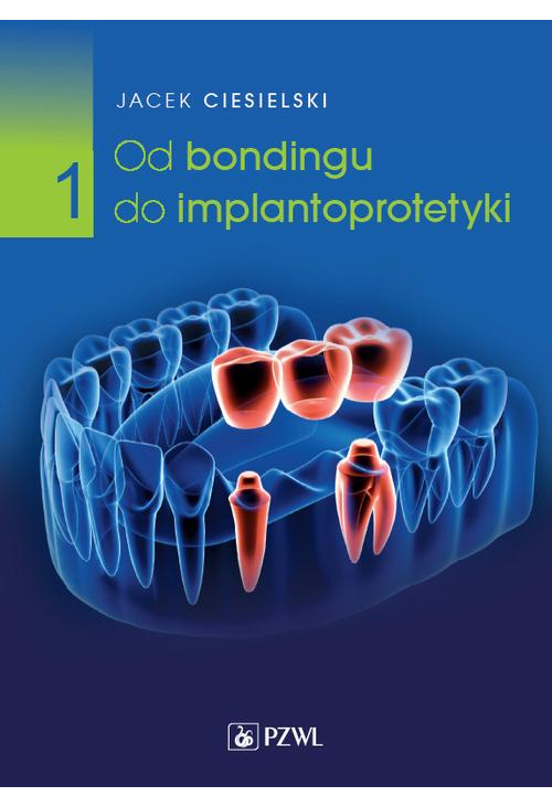 Od bondingu do implantoprotetyki Część 1