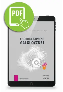 Choroby zapalne gałki...
