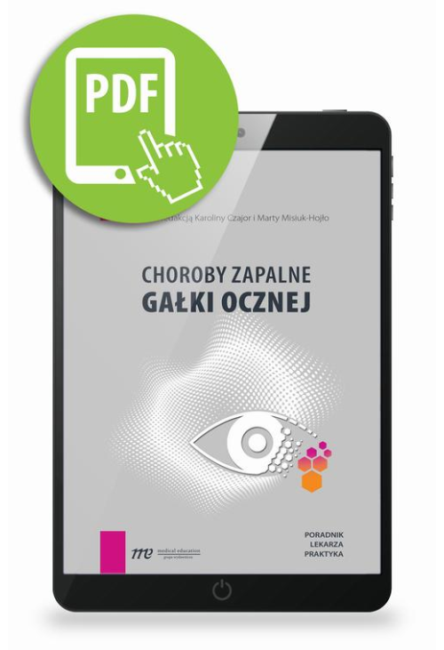 Choroby zapalne gałki ocznej - poradnik lekarza praktyka