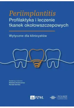 Periimplantitis...