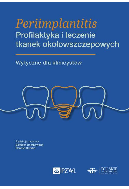 Periimplantitis Profilaktyka i leczenie tkanek okołowszczepowych