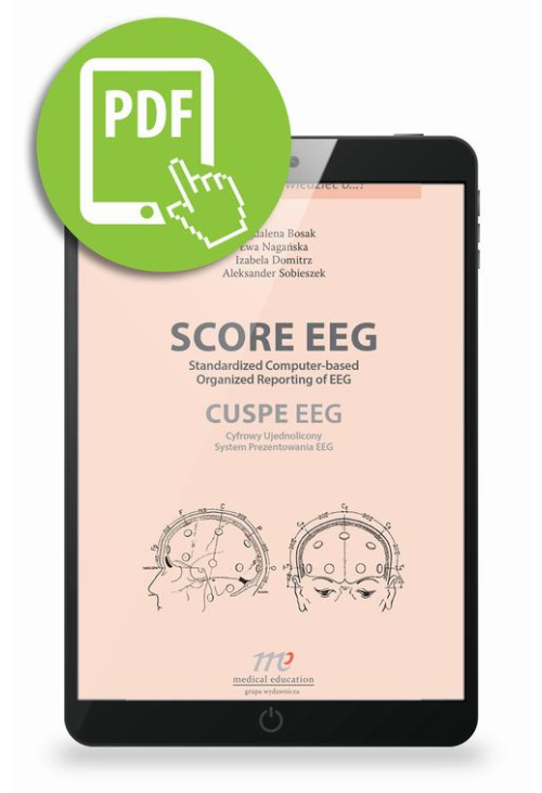 SCORE EEG Standardized Computer-based Organized Reporting of EEG. CUSPE EEG Cyfrowy Ujednolicony System Prezentowania EEG