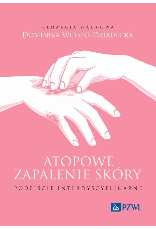Atopowe zapalenie skóry Podejście interdyscyplinarne