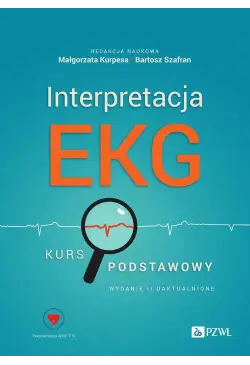 Interpretacja EKG