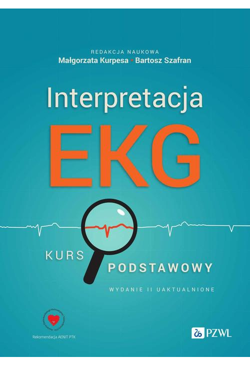 Interpretacja EKG