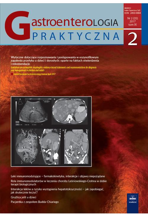 Gastroenterologia Praktyczna 2/2017
