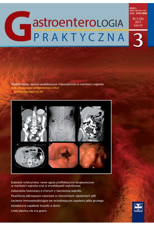 Gastroenterologia Praktyczna 3/2017