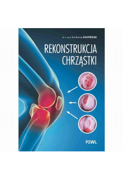 Rekonstrukcja chrząstki
