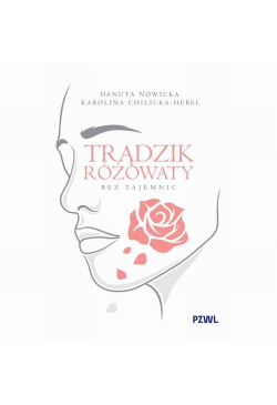 Trądzik różowaty bez tajemnic
