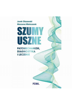 Szumy uszne