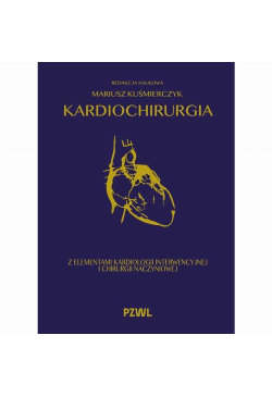 Kardiochirurgia z...