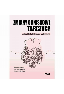Zmiany ogniskowe tarczycy