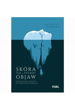 Skóra to „tylko” objaw....