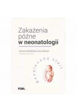 Zakażenia późne w...