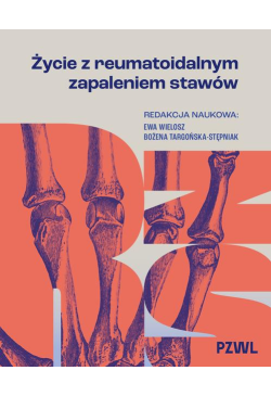 Życie z reumatoidalnym...