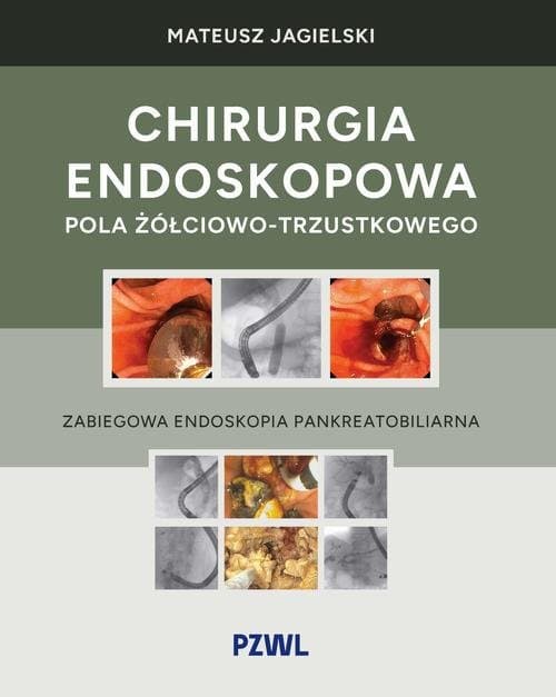 Chirurgia endoskopowa pola żółciowo-trzustkowego — Mateusz Jagielski