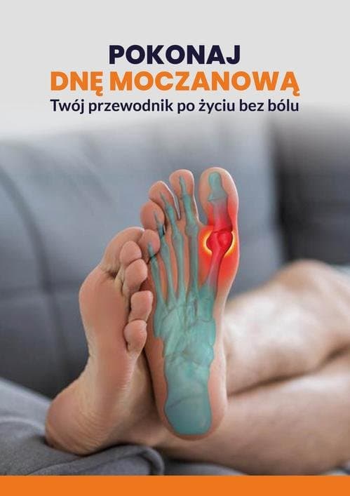 Pokonaj dnę moczanową: Twój przewodnik po życiu bez bólu — Praca Zbiorowa