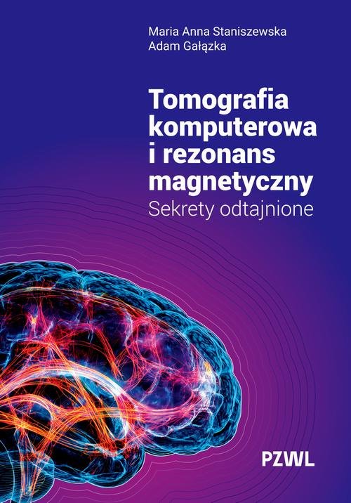 Tomografia komputerowa i rezonans magnetyczny — Maria Anna Staniszewska, Adam Gałązka